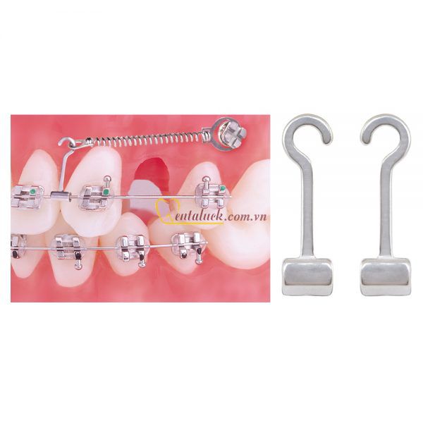 Hooks chỉnh nha (10cái/gói)