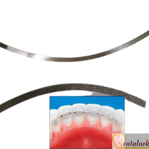 Dây bện cố định mặt lưỡi Lingual Retainer