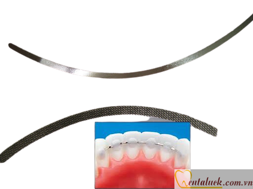 Dây bện cố định mặt lưỡi Lingual Retainer