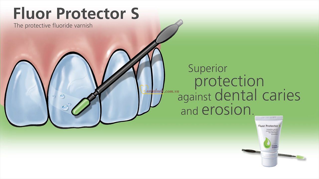 Fluor protector Gel