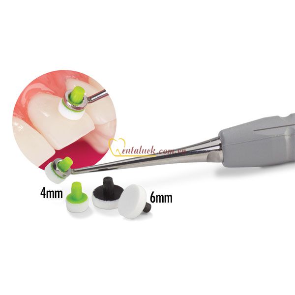 OptraSculpt Pab Refill-60 cái đắp composite hoặc ấn giữ veneer