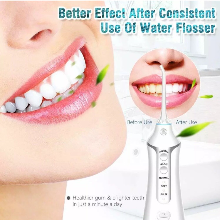 Máy tăm nước Nicefeel – cá nhân