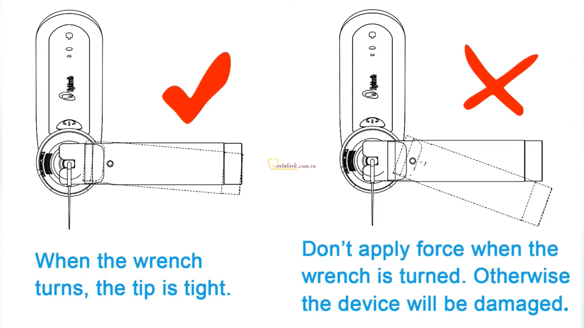 Wrench (cờ lê tháo gắn tip của Ultra X)
