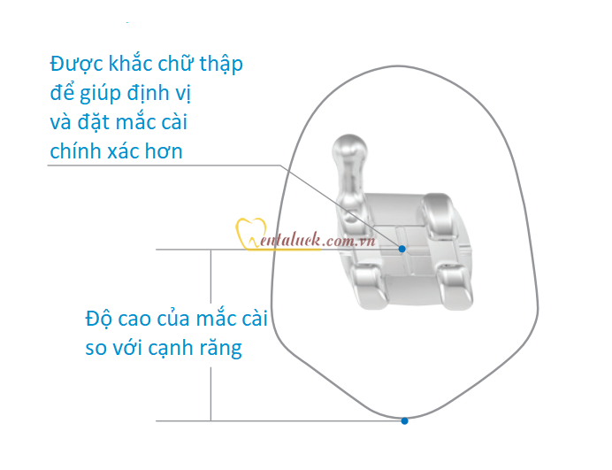 Mắc cài MASEL Bravo Primo