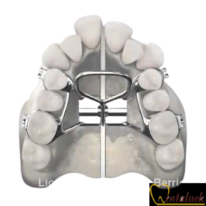 Ốc nong hàm cố định Palatal Expander RPE