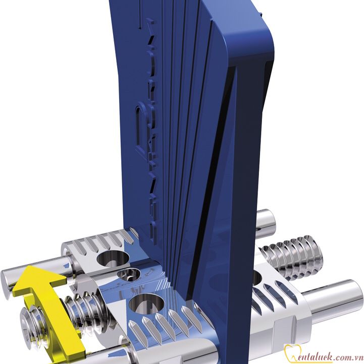 Ốc nong 2 chiều Dentaurum Medium 7,5mm