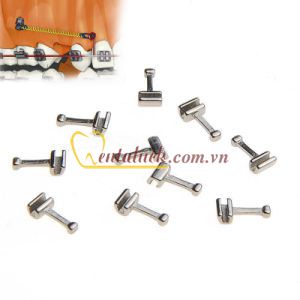 Hooks chỉnh nha (10cái/gói)